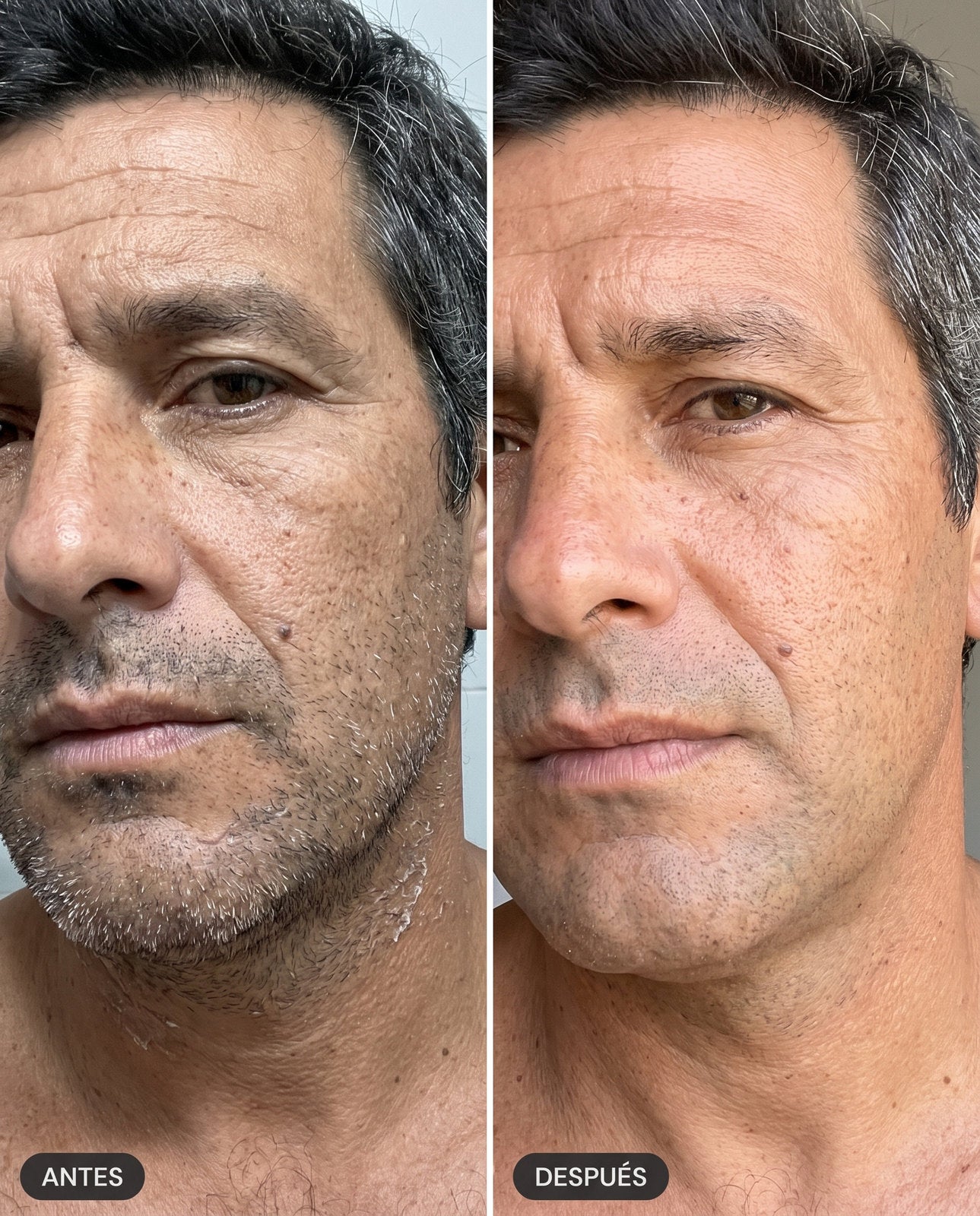 Marcelo, antes y después