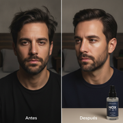 VOLVÉ A TU PRIME | Rejuvenecé tu rostro