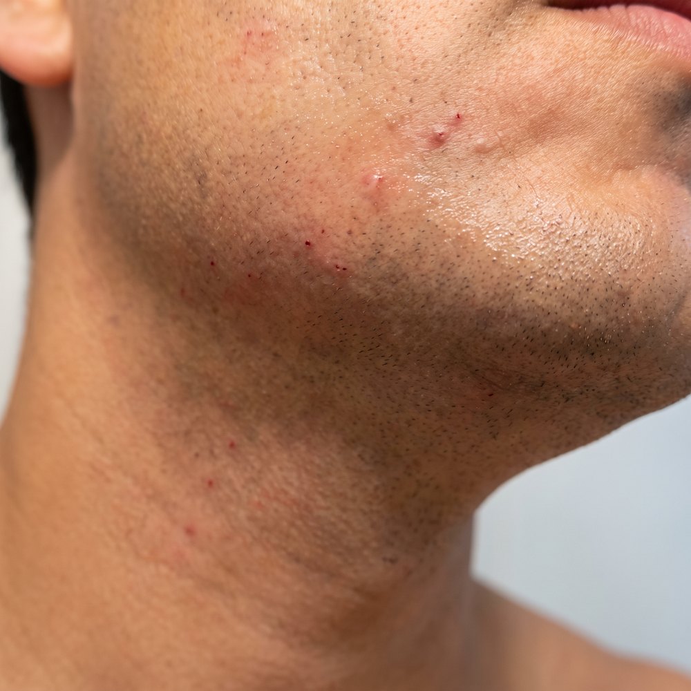 Cuello recién afeitado